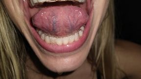 Retainers teeth tongue movements