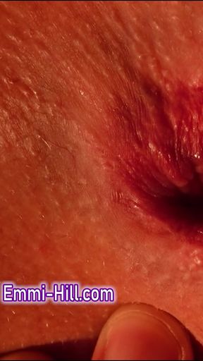 Skinny girl Asshole Close Up Huge Labia