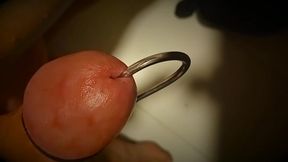 Zora Dual CD playing with urethral catheter