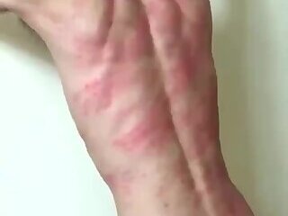 Turkish pain
