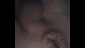 I'_m irritating my hemorrhoidal prolapse