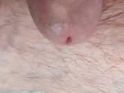 Urethral sounding close up