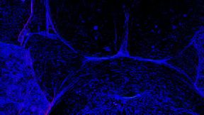 Smarien75 and Shellyseth in the blacklight