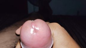 Mastrubation with White Milky Discharge