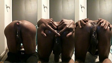 *PREMIUM* Fart On Command Huge Gape Anal