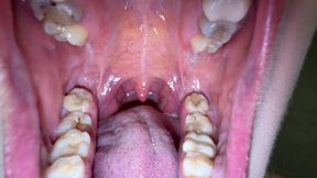Mouth Secrets: Thick White Coating on My Tongue