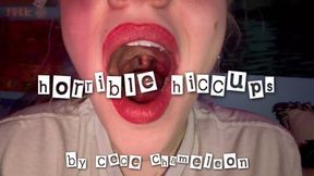 horrible hiccups