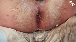 Anal fisting, stretching and speculum play