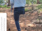 Amputee guy climbing stairs