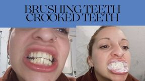Crooked Tooth Fetish and Tooth Brushing Natural Dental