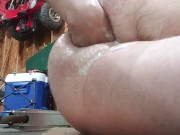 Hard anal fisting and prolapse