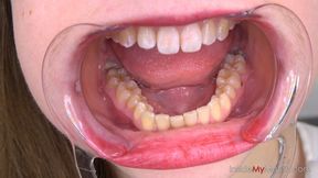 Kate's Intimate Mouth Tour - Extreme Close-Up Tongue, Teeth & Uvula Fetish (MOBILE resolution)