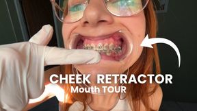 Cheek Retractor; Mouth TOUR