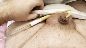 BBW with small dick with bladder catheter and swollen balls: he cums a lot!