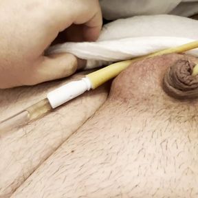 BBW with small dick with bladder catheter and swollen balls: he cums a lot!