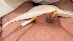 BBW with small dick with bladder catheter and swollen balls: he cums a lot!