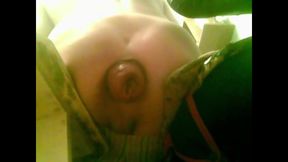 A Young Guy Is Sitting on a Chair with Anal Prolapse