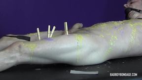 Pinching pegs leave welts