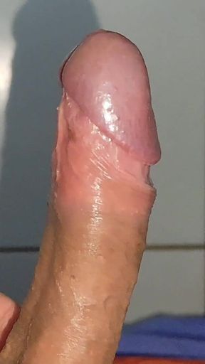 Large Deformed Cock with Lumpy Glans.