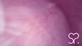 Fucked in my Pussy   Camera in my Bladder = Crazy Bulge!