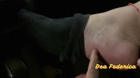 Piedini puzzolenti dopo 17 giorni