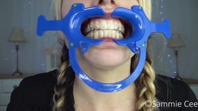 JOI for retainers