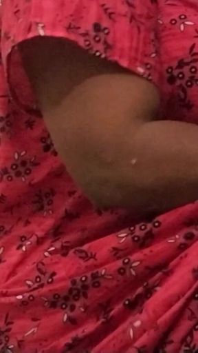 Hot Leg