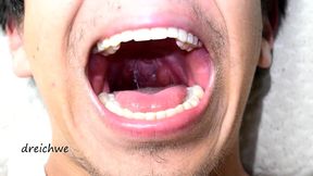 deep uvula