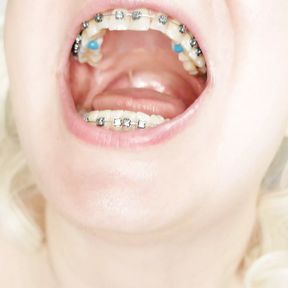 braces fetish: close up video mukbang