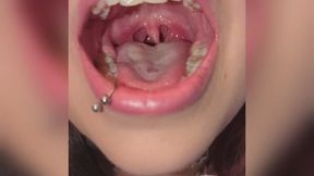 my cute uvula