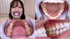 Serina Usui - Watching Inside mouth of Japanese cute girl