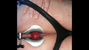 Speculum anal play
