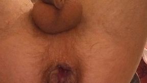 my hot anal masturbation with prolapse