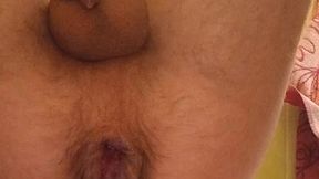 my hot anal masturbation with prolapse