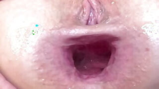 Gaping, fisting – scopata anale hardcore per una MILF amatoriale in calze