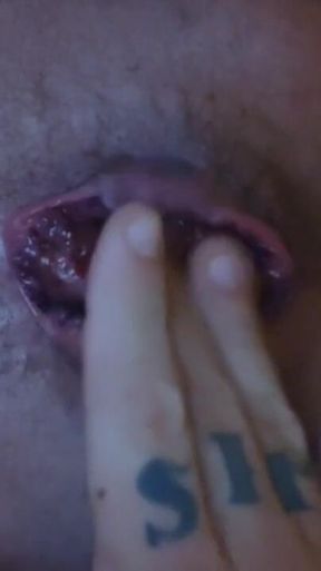 My Hole
