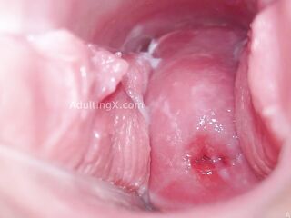 Cervix Display and Speculum Play