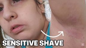 Irritated Armpit Gets Shaved Anyway