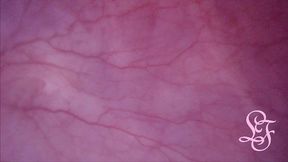 fucked in my pussy + camera in my bladder = crazy bulge!