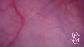 fucked in my pussy + camera in my bladder = crazy bulge!