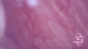 fucked in my pussy + camera in my bladder = crazy bulge!