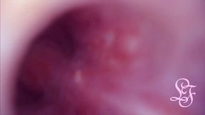 fucked in my pussy + camera in my bladder = crazy bulge!