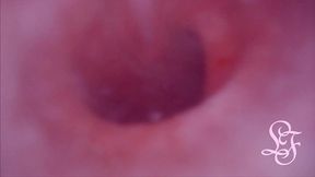 fucked in my pussy + camera in my bladder = crazy bulge!