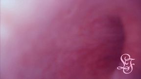 fucked in my pussy + camera in my bladder = crazy bulge!