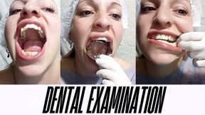 Dental Examination, cavities, crooked teeth, tongue, throat