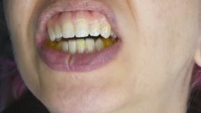 Gummy Fishes Get Sucked, Chewed, and Swallowed Down Her Hungry Throat