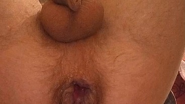 My hot anal masturbation with prolapse