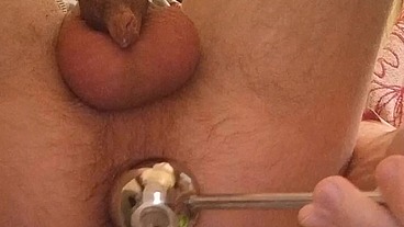 My hot anal masturbation with prolapse