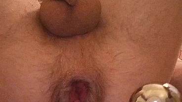 My hot anal masturbation with prolapse