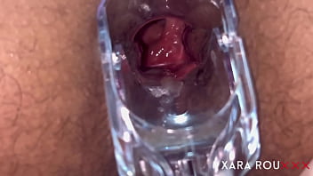 Anal Speculum opens up tight virgin ass